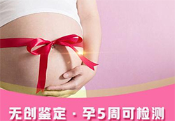 吉安怀孕14周如何办理无创孕期亲子鉴定，在吉安做无创怀孕亲子鉴定怎么收费